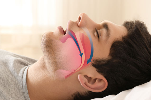 sleep apnea graphic St. Johns, MI